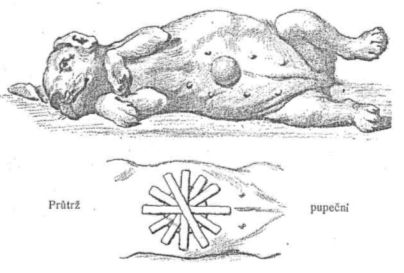 Pr�tr� pupe�n�